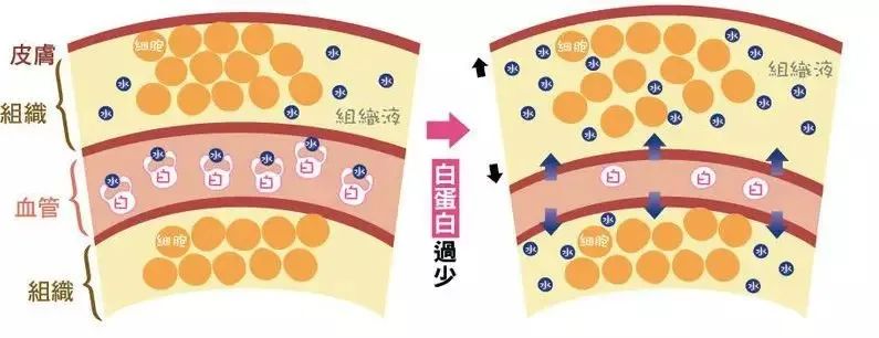 造成虚胖的五大原因,您知道吗？(图8)