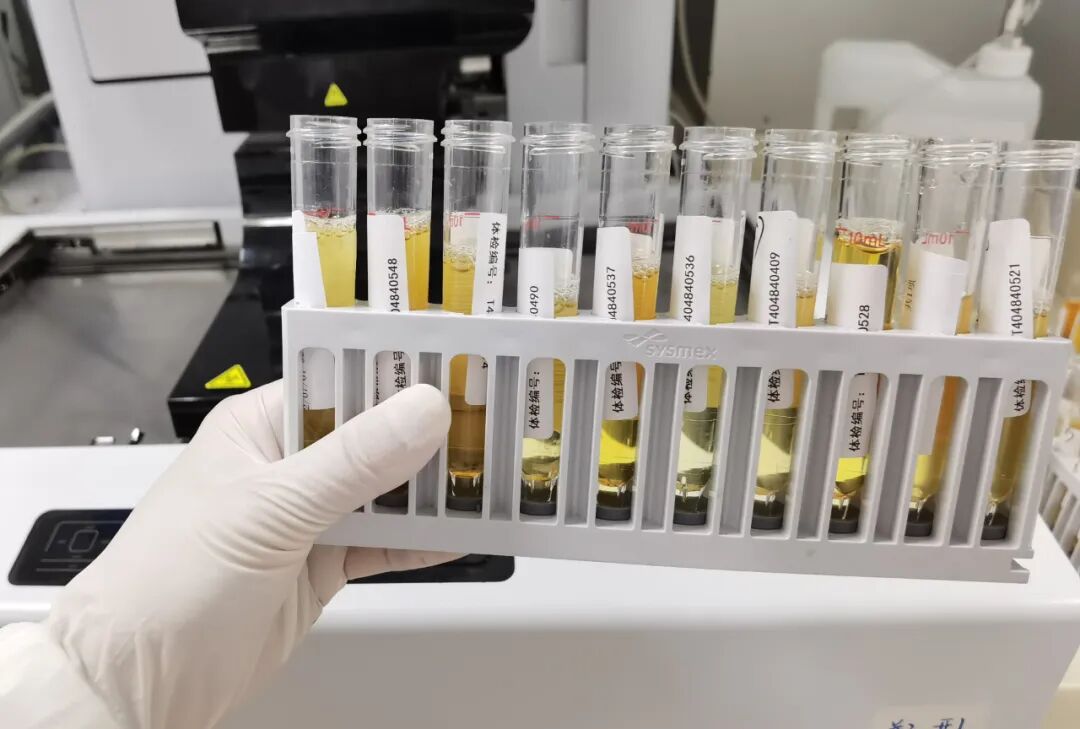 化验大便怎么采集如何获取一份合格的大小便标本？很多人做错了_https://www.jmylbn.com_新闻资讯_第10张