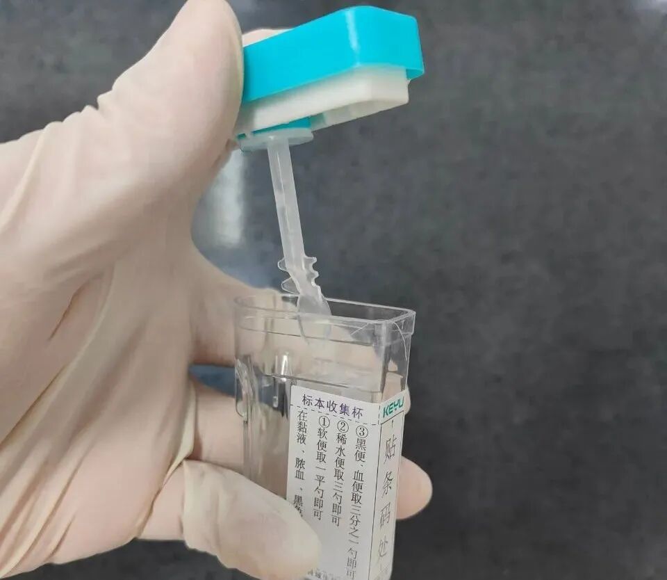 化验大便怎么采集如何获取一份合格的大小便标本？很多人做错了_https://www.jmylbn.com_新闻资讯_第12张