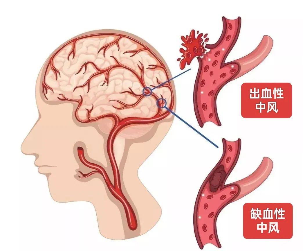 头晕冒冷汗脸色发白全身无力是怎么回事