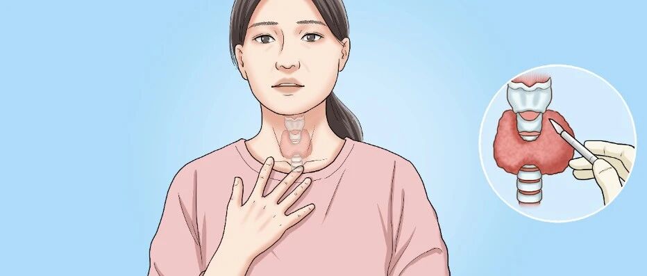 这种癌症，女性发病率是男性的3倍！