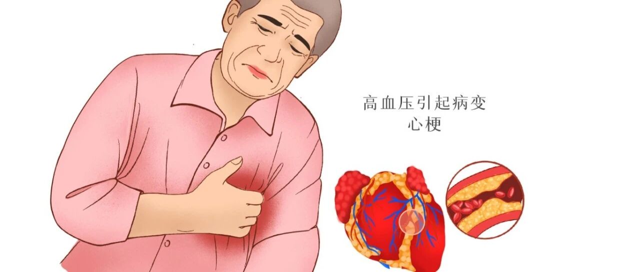 心悸、心梗也高发于春季，疾病的前兆你意识到了吗？