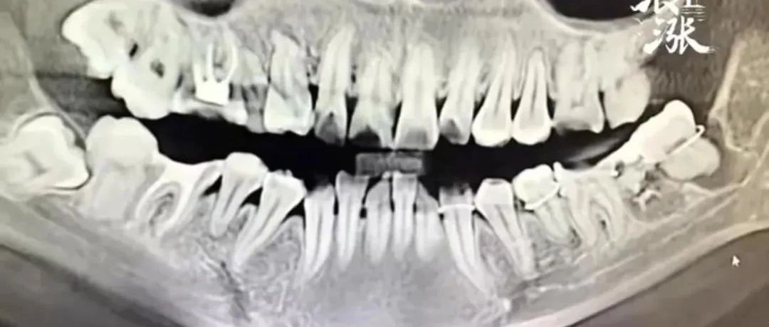 cover_image
