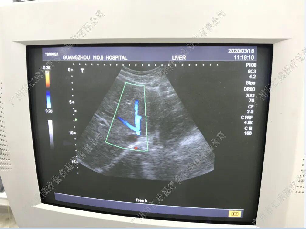 东芝超声怎么设置时间东芝SSA-550A开不了机故障维修_https://www.jmylbn.com_新闻资讯_第4张