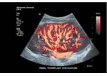 彩超怎么判断故障飞利浦EPIQ5四维彩超图像伪影故障维修_https://www.jmylbn.com_新闻资讯_第2张