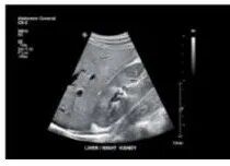 彩超怎么判断故障飞利浦EPIQ5四维彩超图像伪影故障维修_https://www.jmylbn.com_新闻资讯_第1张