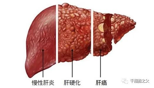 预防儿童近视要点 平时做好6点 保护孩子的视力 娱乐新鲜事