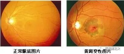 新无限医疗怎么加盟干细胞再续生命的无限可能，在难治性疾病治疗上带来新突破_https://www.jmylbn.com_新闻资讯_第4张