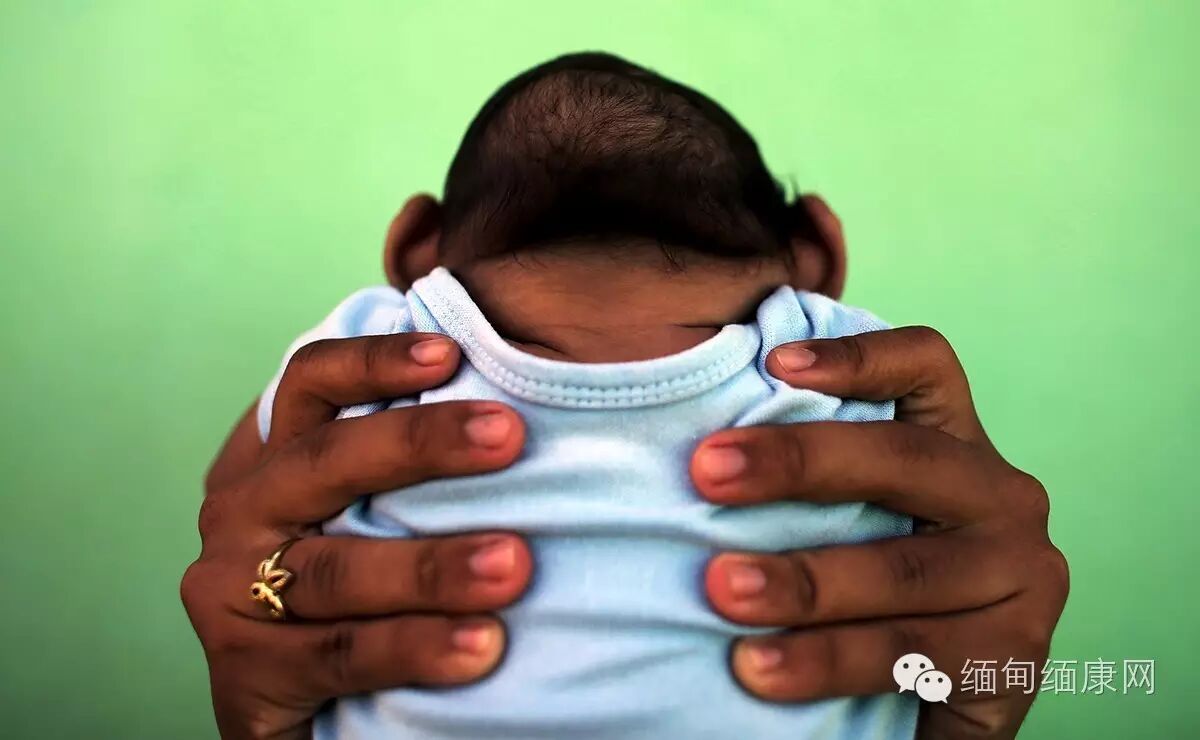 寨卡病毒(英语:zika virus, zikv,马新译作兹卡病