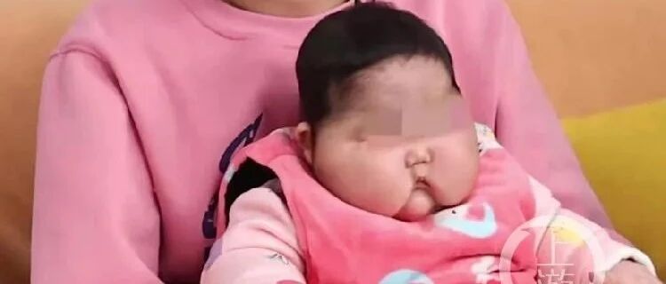 婴儿被爆用抑菌霜后变“大头娃娃”，卫健委：下架！调查！