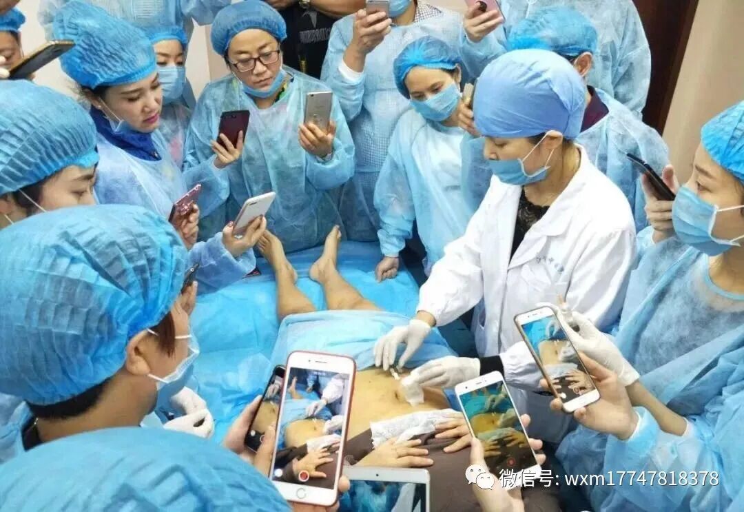 pga和pgla有什么区别早读 ｜ 线雕干货！5大角度深度讲解_https://www.jmylbn.com_新闻资讯_第37张