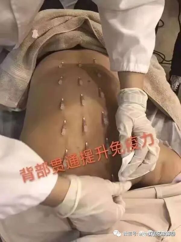 pga和pgla有什么区别早读 ｜ 线雕干货！5大角度深度讲解_https://www.jmylbn.com_新闻资讯_第11张