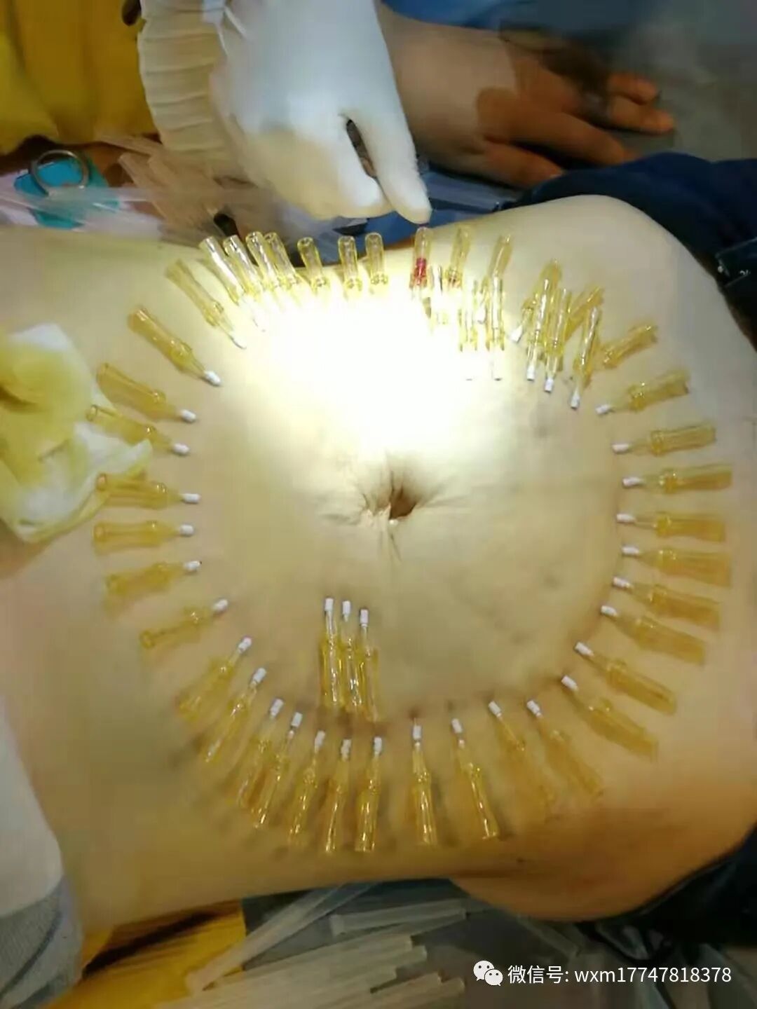 pga和pgla有什么区别早读 ｜ 线雕干货！5大角度深度讲解_https://www.jmylbn.com_新闻资讯_第24张