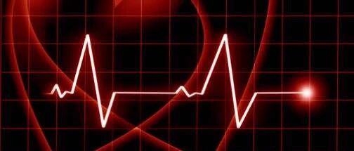 心血管疾病有哪几种类型？