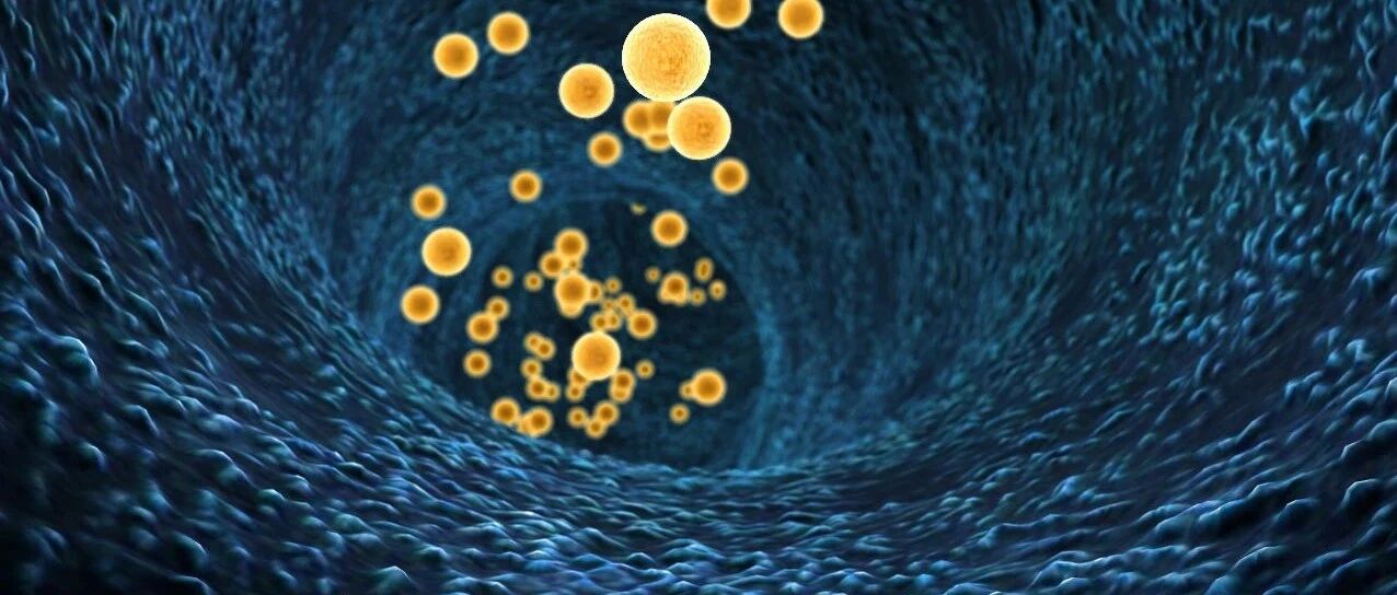 老年人晚上腿抽筋要警惕动脉硬化