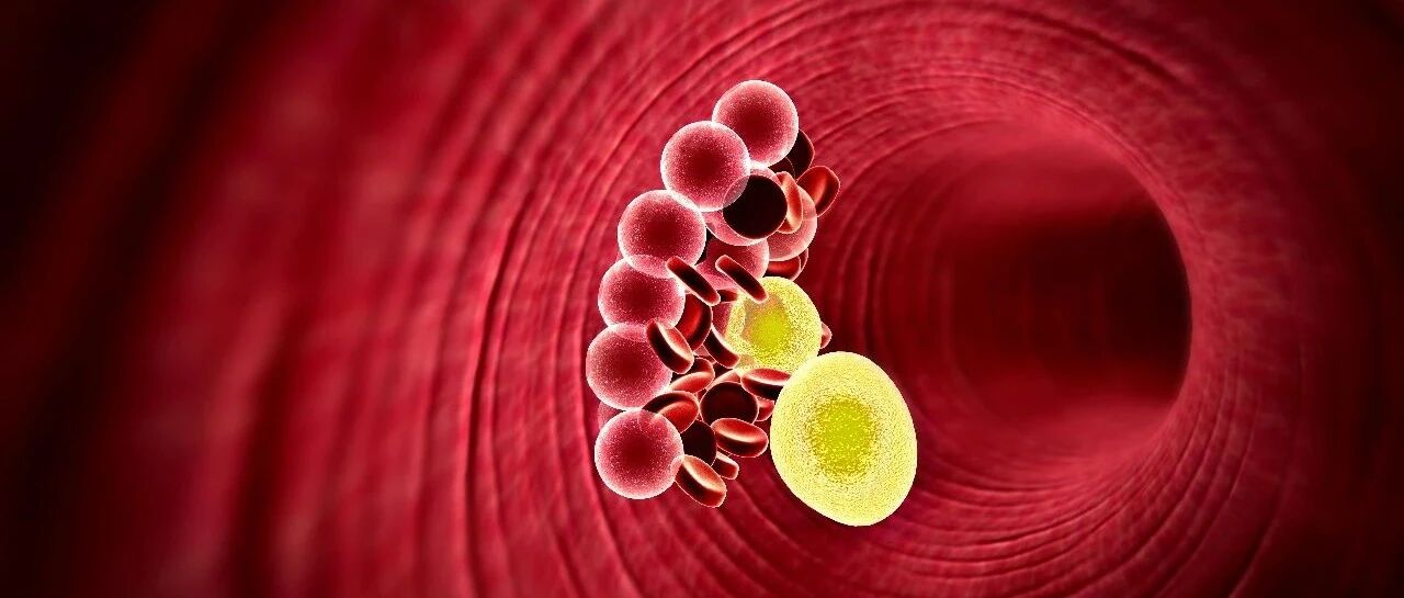 甘油三酯升高可以使用深海鱼油来治疗吗？