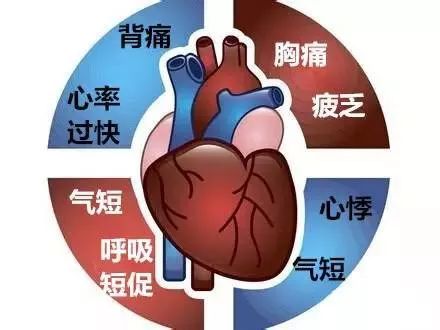 心臟病五大早期症狀 你中招了嗎？ 健康 第3張