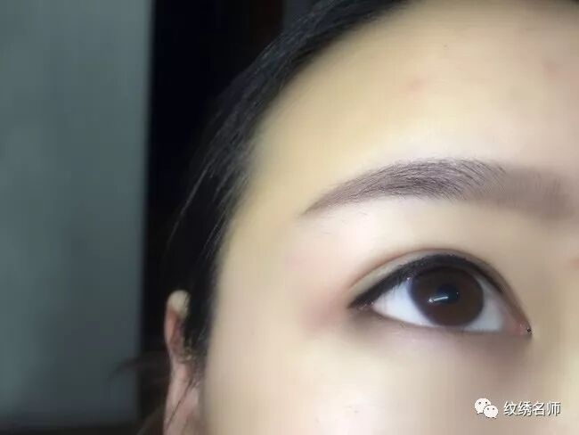 美瞳线掉痂期间能抠吗 不能抠 纹绣名师 微信公众号文章阅读 Wemp