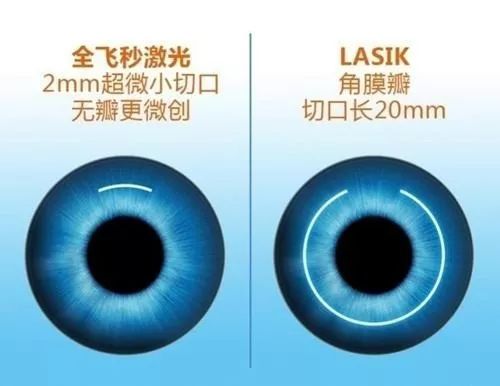 西安佰视佳眼科