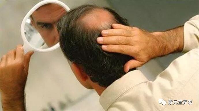 头发的状况反映出哪些健康问题 日常该如何护发