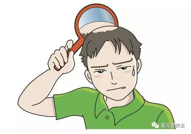 为什么90后未老先秃 该如何进行调理