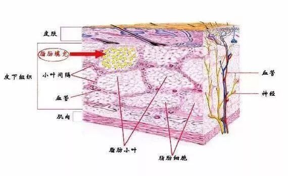 由于肌肉的起止点,深浅组织的边界融合等解剖结构,移植的脂肪更是不会