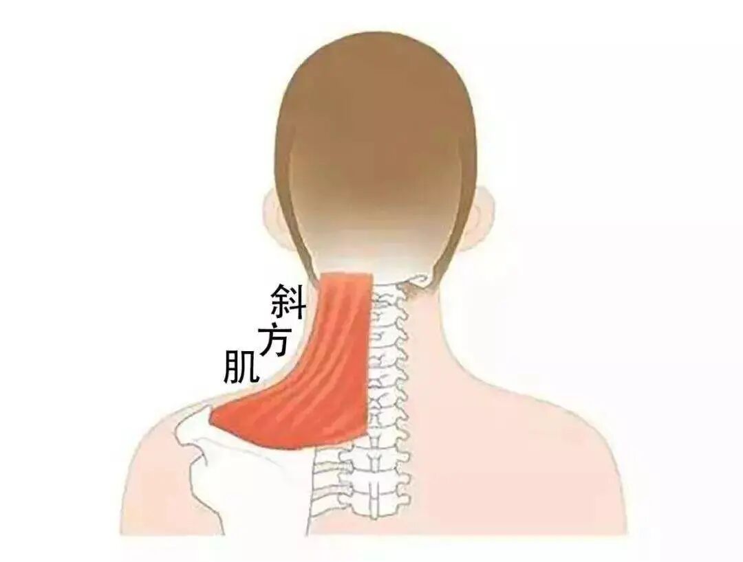 斜方肌发达还想要直角肩?_医学界-助力医生临床决策和职业成长