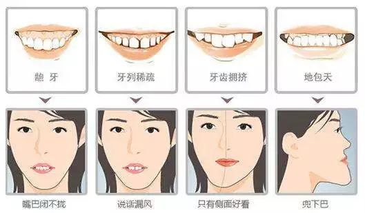 牙齿矫正过程中的5个 痛点 郑州正合口腔门诊部 微信公众号文章阅读 Wemp