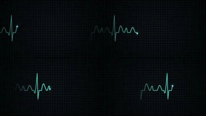 多普勒彩超图怎么看四道科普 ｜ 分不清心电图和心彩超？今天专家就来为您解答_https://www.jmylbn.com_新闻资讯_第3张