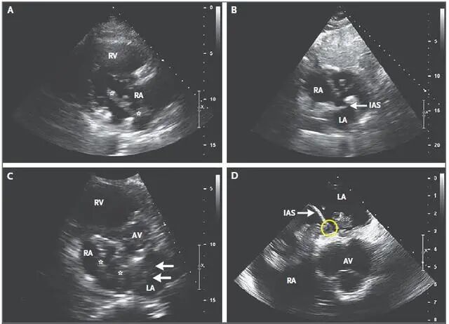 多普勒彩超图怎么看四道科普 ｜ 分不清心电图和心彩超？今天专家就来为您解答_https://www.jmylbn.com_新闻资讯_第4张