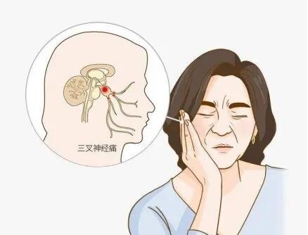 射频什么科【图文解析】疼痛科常用的射频治疗是什么疗法？可以治疗什么疾病？_https://www.jmylbn.com_新闻资讯_第13张