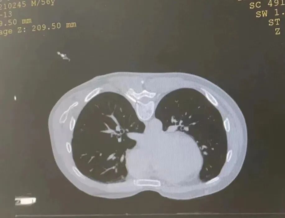 射频什么科【图文解析】疼痛科常用的射频治疗是什么疗法？可以治疗什么疾病？_https://www.jmylbn.com_新闻资讯_第8张