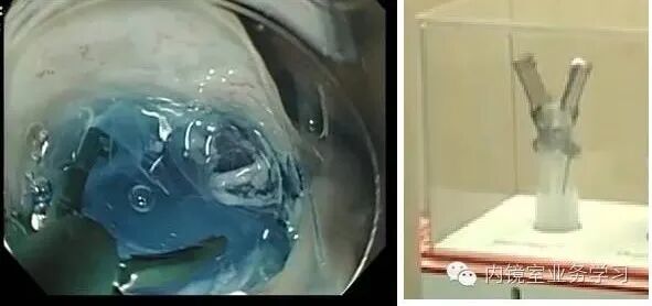 高频刀是什么内镜用高频电刀，你在用哪个？_https://www.jmylbn.com_新闻资讯_第9张