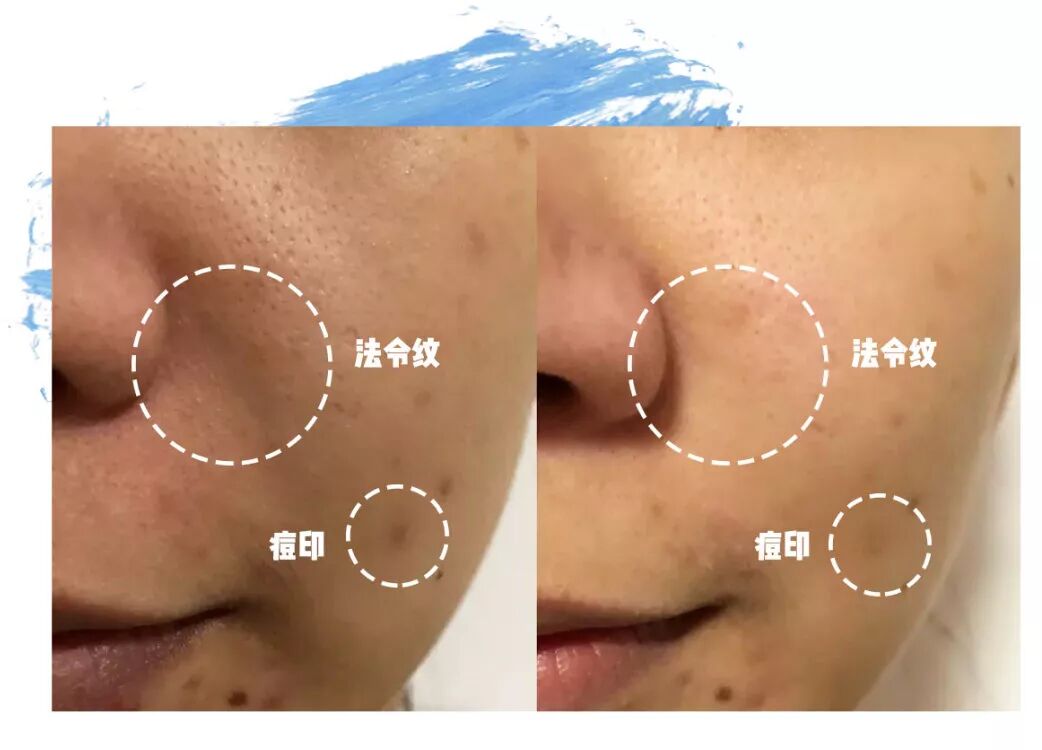 章小惠力推 和la Prairie比肩 這個貴婦品牌我用過之後都驚了 買手客buyerkey 微文庫