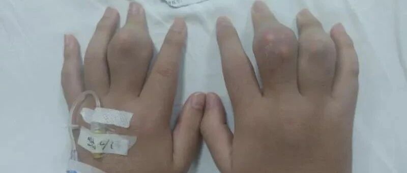 因为常喝它，18岁就无法走路！