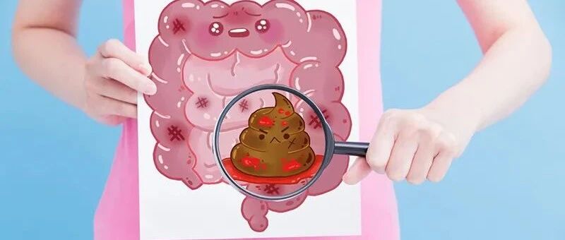 大便粘马桶是癌症信号？便后这件事一定要做…