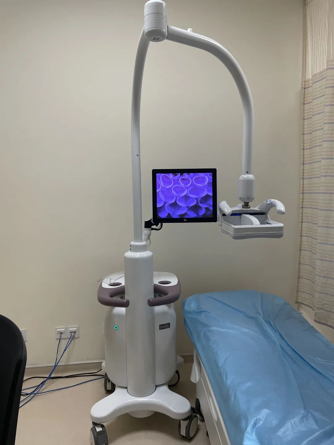 什么叫超声容积探头它是女性健康第一杀手，但早期治愈率达90%以上！最先进的自动乳腺超声成像系统来啦！_https://www.jmylbn.com_新闻资讯_第9张