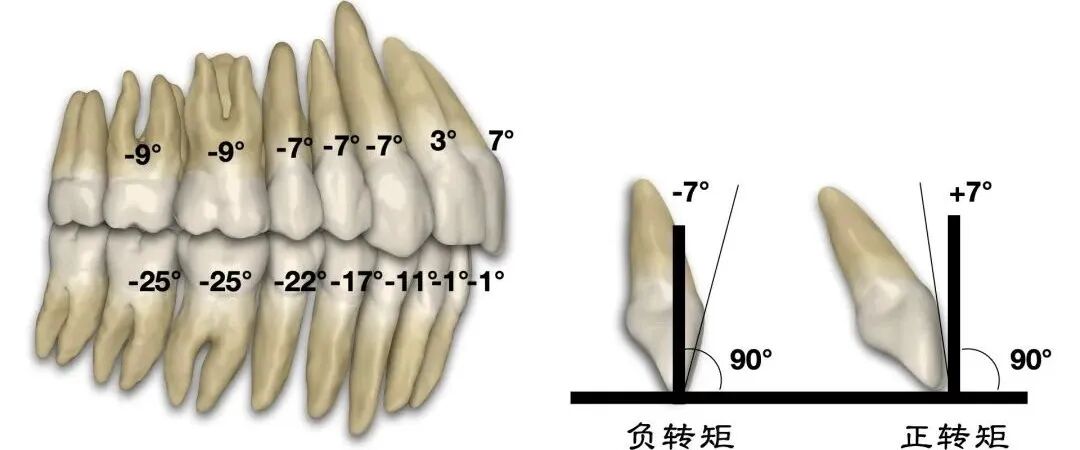 弓丝成型器怎么使用正畸 ｜ 正畸常用钳及附件，一篇认全！_https://www.jmylbn.com_新闻资讯_第72张