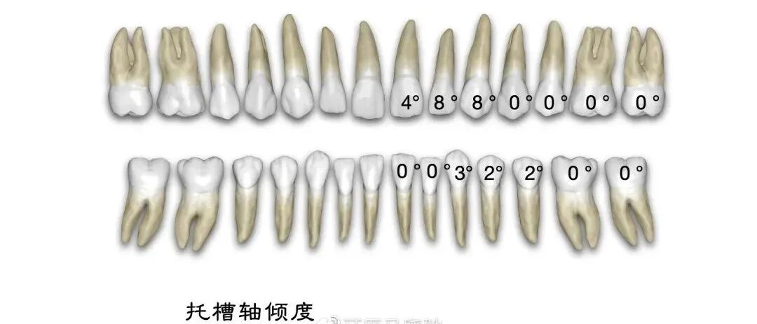 弓丝成型器怎么使用口腔精读 ｜ 图文详解：正畸常用钳及附件，一篇认全！_https://www.jmylbn.com_新闻资讯_第72张