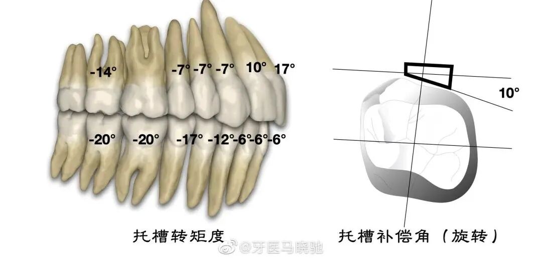 弓丝成型器怎么使用正畸 ｜ 正畸常用钳及附件，一篇认全！_https://www.jmylbn.com_新闻资讯_第73张