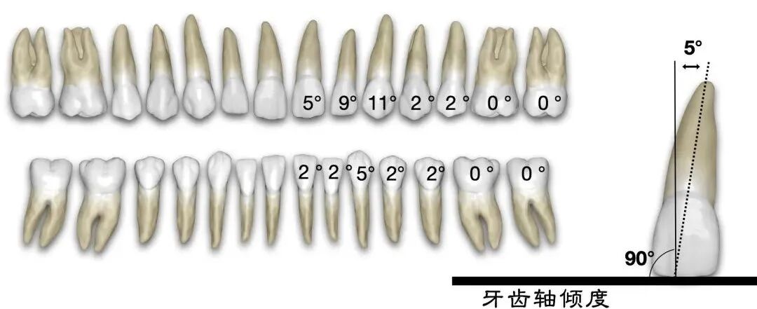 弓丝成型器怎么使用口腔精读 ｜ 图文详解：正畸常用钳及附件，一篇认全！_https://www.jmylbn.com_新闻资讯_第71张