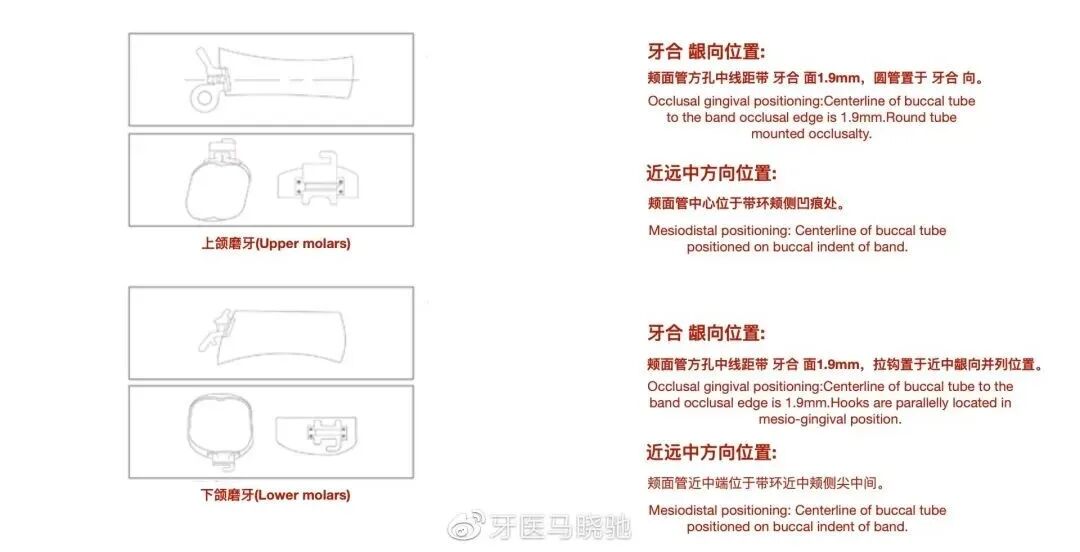 弓丝成型器怎么使用口腔精读 ｜ 图文详解：正畸常用钳及附件，一篇认全！_https://www.jmylbn.com_新闻资讯_第63张