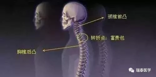 頭暈、眼花,半夜睡覺脖子還老不舒服?這是病,得治! 頭暈、眼花,半夜睡覺脖子還老不舒服?這是病,得治!