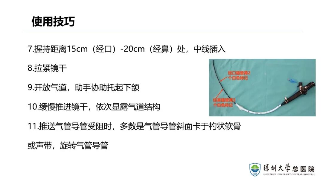 可弯曲支气管镜的使用注意事项_医学界-助力医生临床决策和职业成长