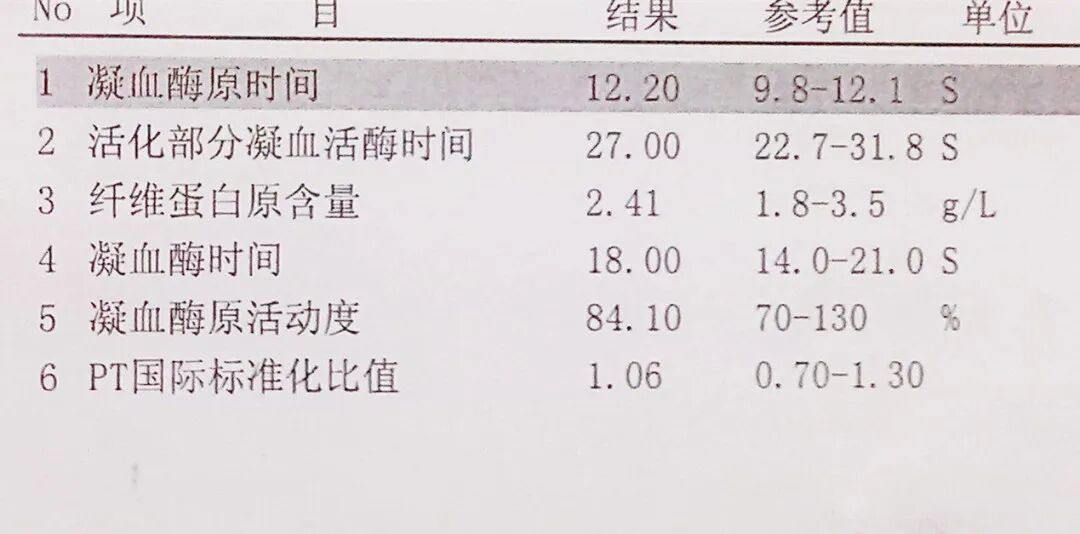 为什么采用4个血凝单位凝血四项异常值解读_https://www.jmylbn.com_新闻资讯_第2张