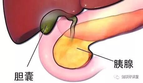 胆囊结石 胆囊息肉和胆囊癌到底有多大相关性 健康好讲堂 微信公众号文章阅读 Wemp