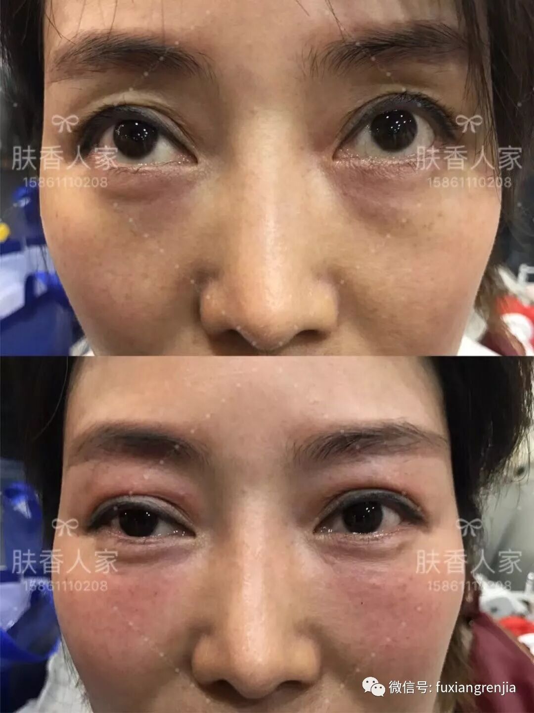 面相告诉你什么叫天机 肤香人家 微信公众号文章阅读 Wemp