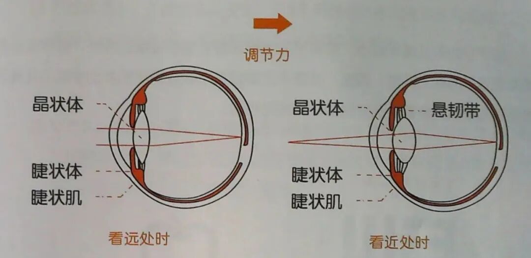 儿童保健电脑怎么用卫生保健：呵护明眸 ‘睛’彩一生（二）——儿童近视早发现_https://www.jmylbn.com_新闻资讯_第11张