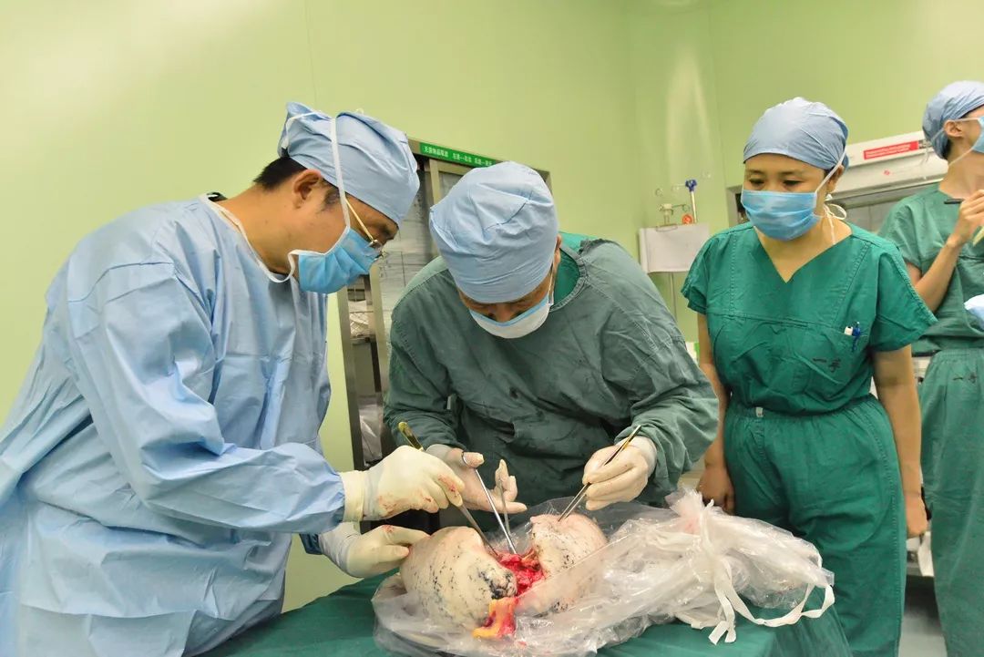 黑龍江省首例非體外循環下DBD序貫雙肺移植手術在我院完成 遊戲 第16張