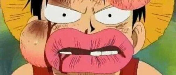 笑话：我的好身材原因······被打肿的！